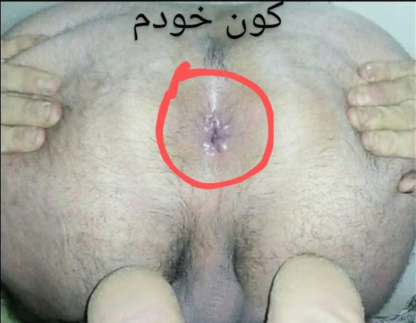 لایو زنه بدون شورت لایو گذاشته کصش معلومه