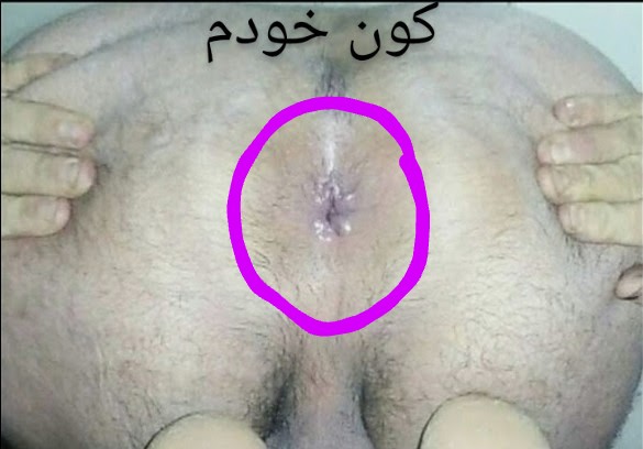 لایو کص نمایی فرناز مرادی