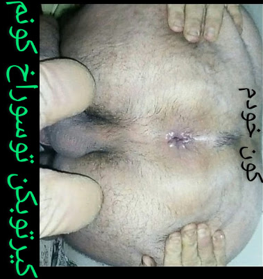 لایو داف ممه گنده نوک ممه هاش از سوتینش معلومه