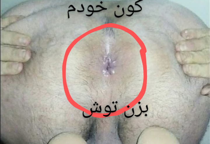 قسمت دوم لایو دوتا خواهر خوشگل که نوک ممه های همدیگرو میخورن