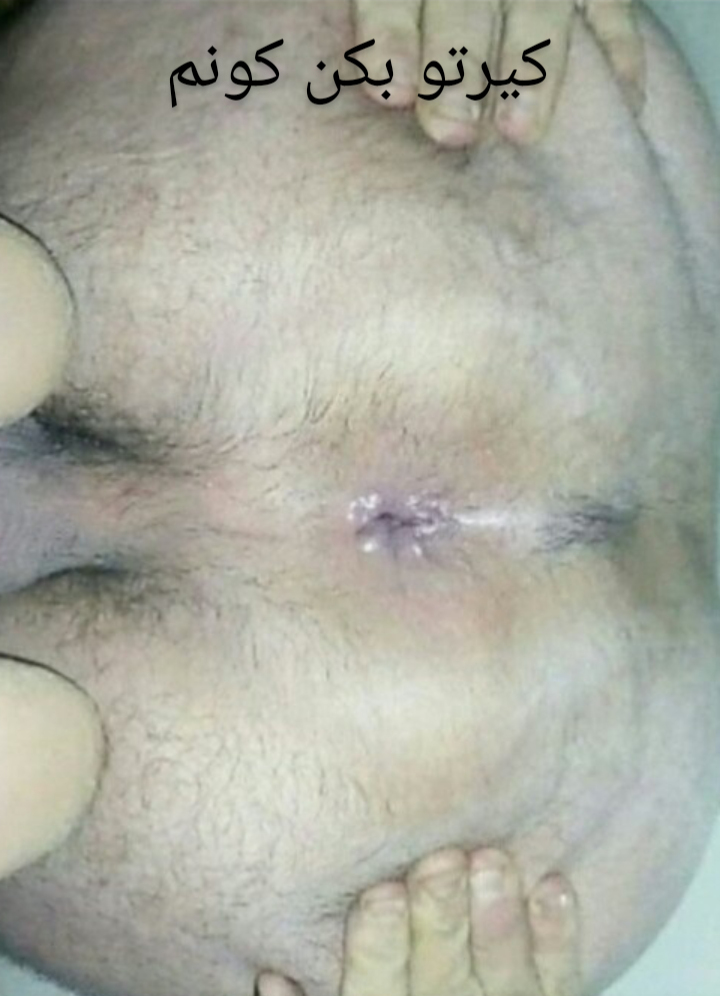 لایو میلف ایرانی با چهره که تو لایو شورت میپوشه بدن نمایی میکنه چه رونای گوشتی هم داره